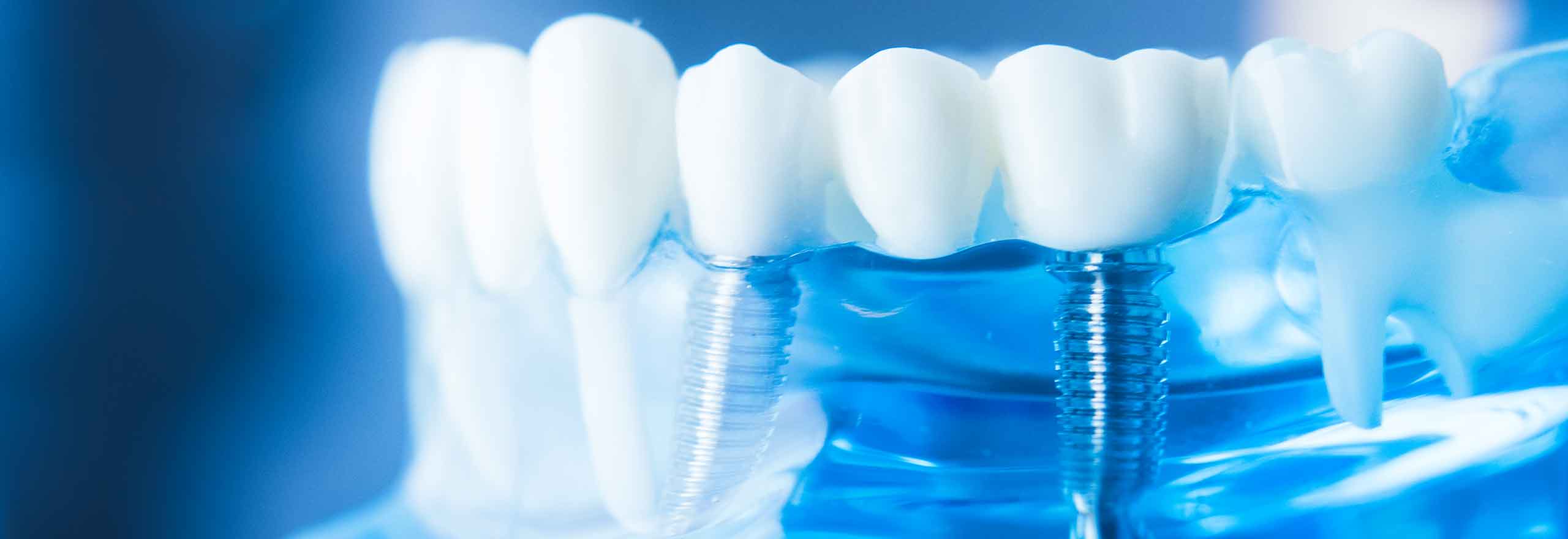 Dental implants in a dentistry teaching model  