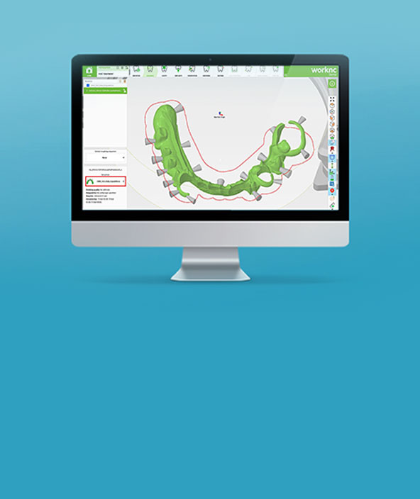 歯科用アプリケーションのスクリーンショットを掲載したコンピューター画面の画像