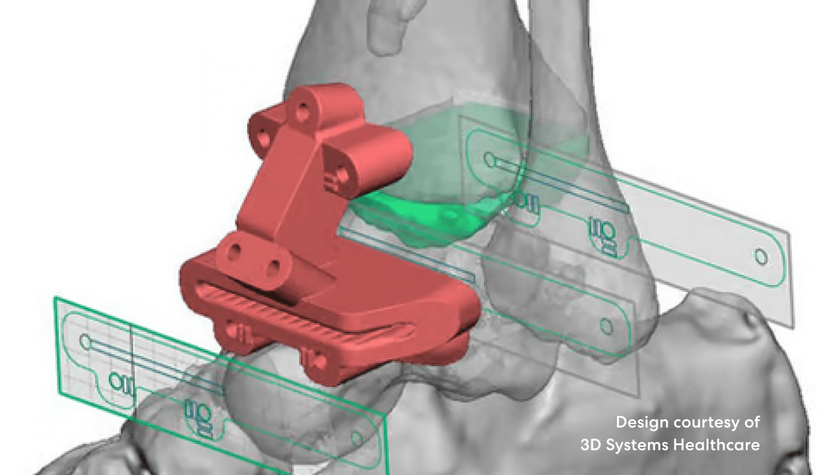 Geomagic Freeform - Unconstrained modeling